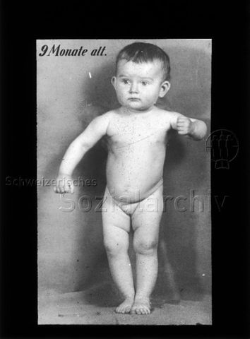 Diaserie zum Thema Säuglingspflege; "9 Monate alt" - stehendes Kleinkind; um 1930