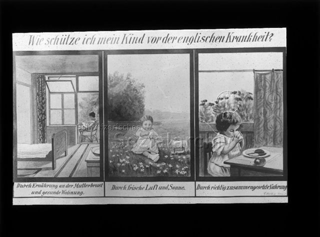 Diaserie zum Thema Säuglingspflege, Krankheiten; "Wie schütze ich mein Kind vor der englischen Krankheit?" - Illustrationen zu den Massnahmen "Durch Ernährung an der Mutterbrust und gesunde Wohnung", "Durch frische Luft und Sonne", "Durch richtig zusammengesetzte Nahrung"; um 1930