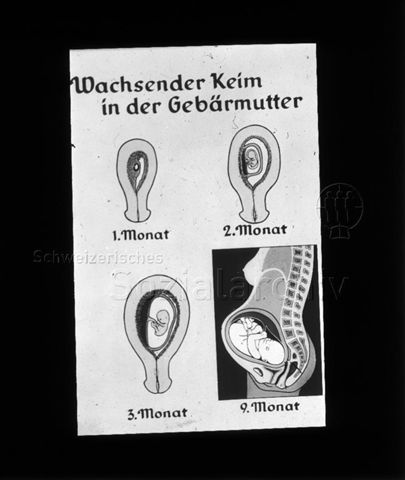 Diaserie zum Thema Schwangerschaft, Geburt, Entwicklung des Kindes und die weibliche Brust; "Wachsender Keim in der Gebärmutter" - Illustration com 1., 2., 3. und 9. Monat; um 1956